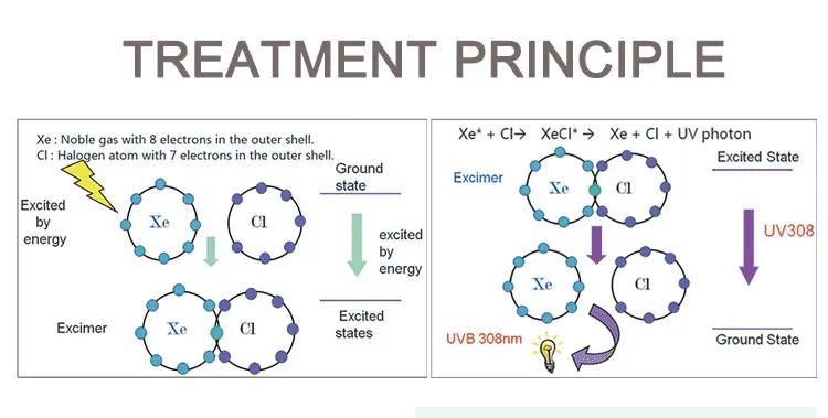 Top Selling LED 308nm Laser Machine for white spot