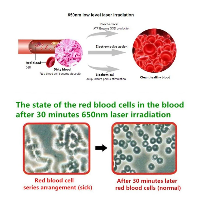 650nm Laser Therapy Wrist Watch for Diabetes Cure Hypertension Blood Purification