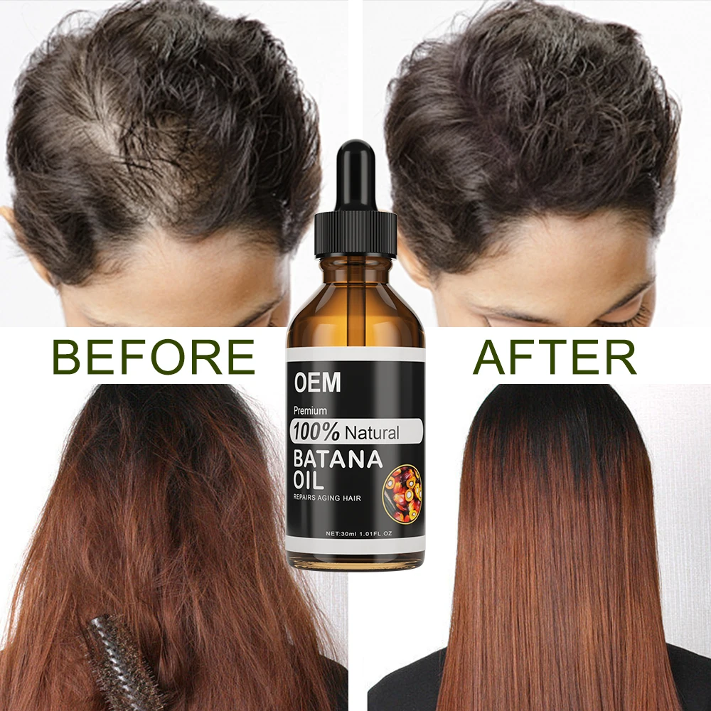 Batana Oil For Hair Growth Private Label Honduras Organic Essential Oil In Bulk Stimulate Scalp Hair Follicles DHT Blocker Serum