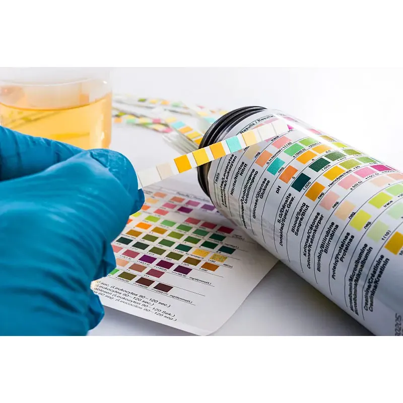 Manufacturers Wholesale Urine Test Paper 10 Parameters 11 Parameters Independent Packaging Urine Test Paper Test