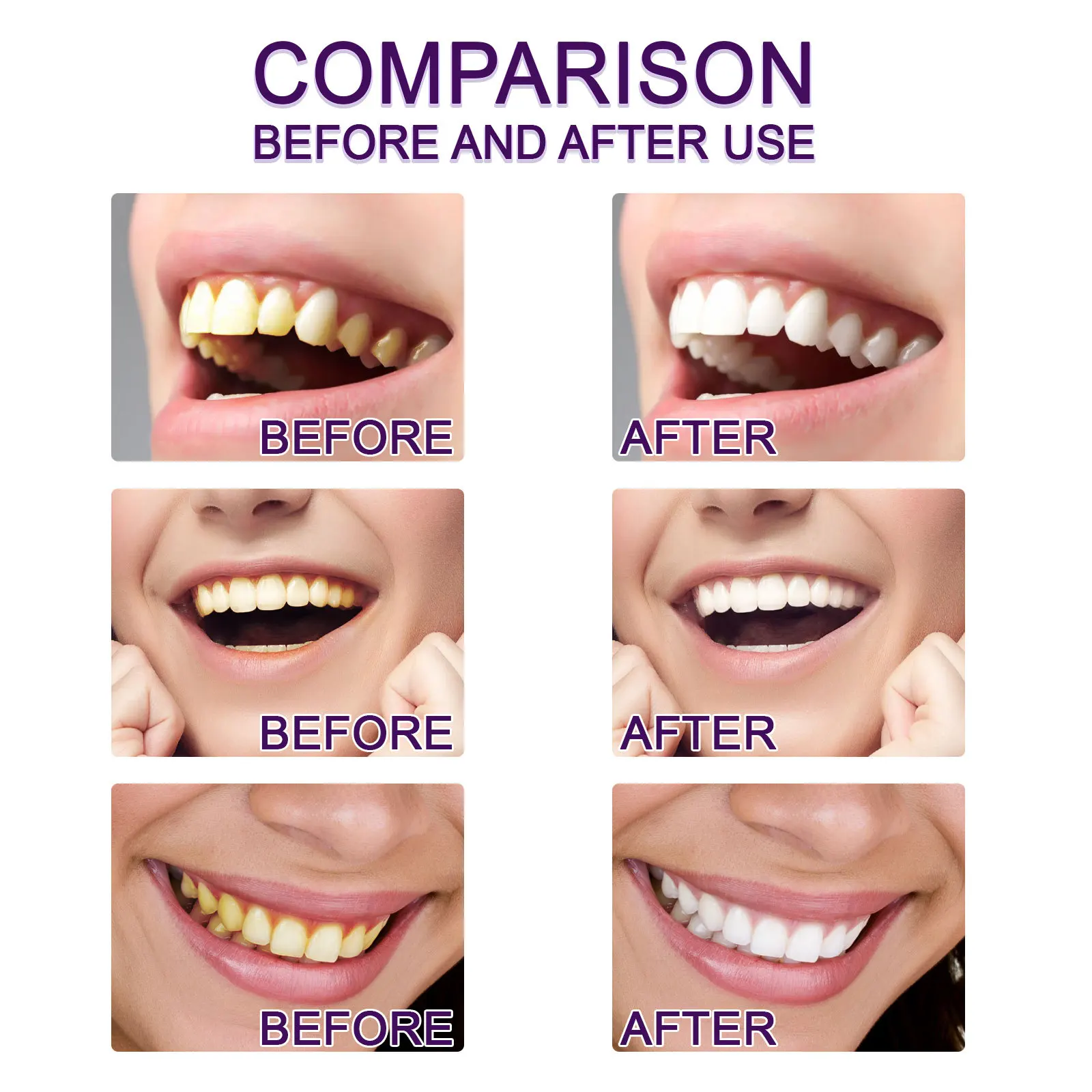 2023 V34 Purple Dental Bleaching Tooth Pen White Teeth Teeth Whitening Pencil Pen