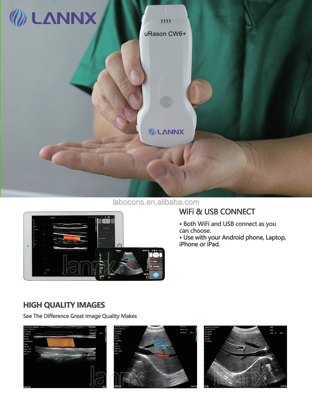 LANNX uRason CW6+ Customized Medical Wireless Convex Linear array probe ultrasound portable wifi ultrasound probe scanner system