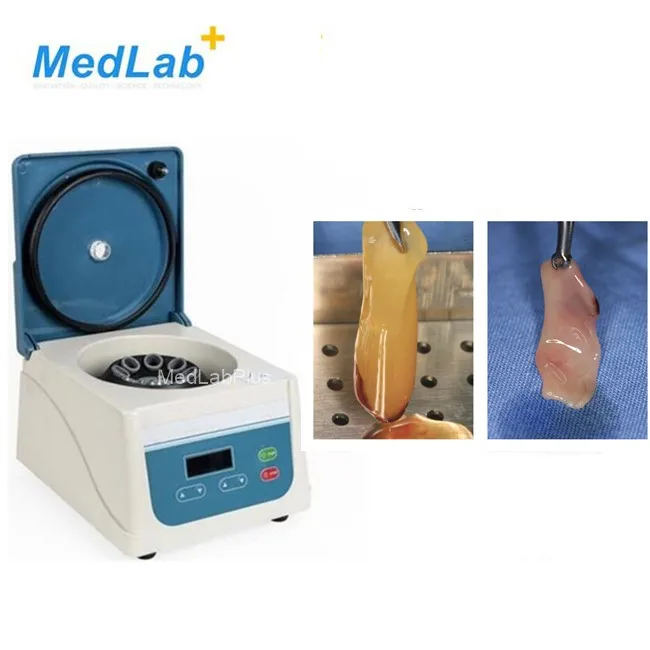 prf tube for prf centrifuge use for prf box