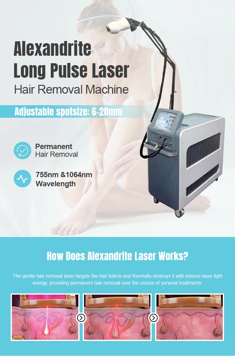 laser alexandrite (1)