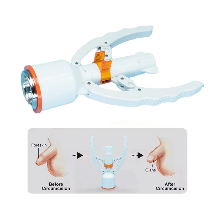 Одноразовый хирургический круговой степлер для фимоза, хирургический режущий степлер для мужчин и взрослых