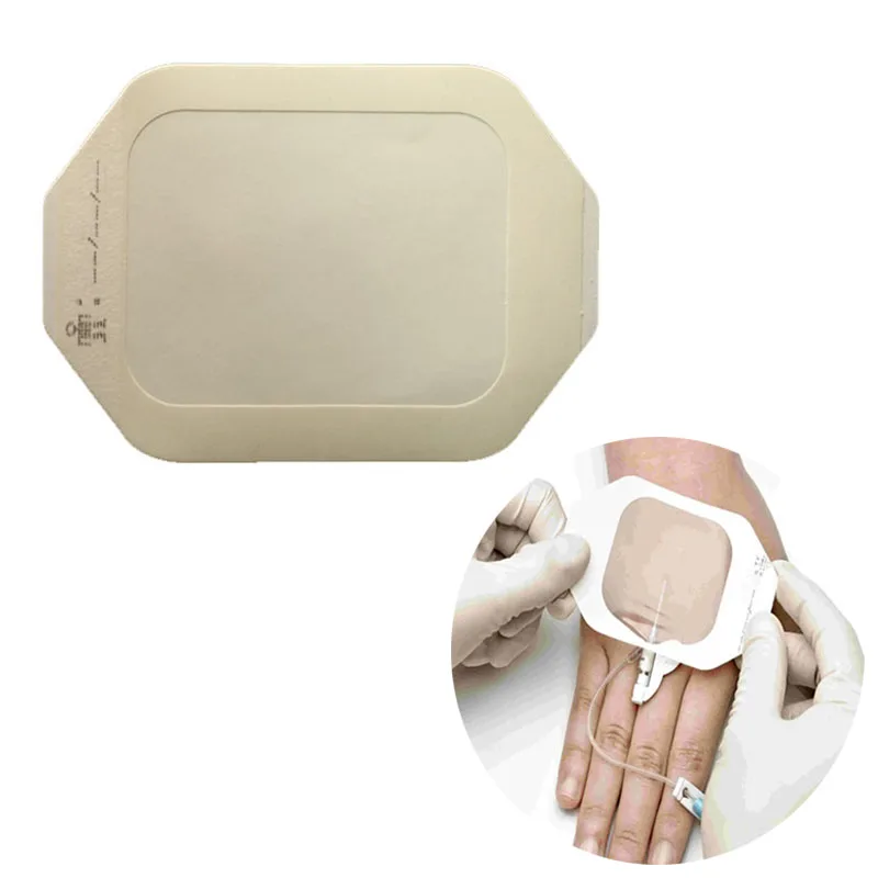 Wound Iv Catheter Fixing Dressing Waterproof Transparent Iv Wound Cannulae Dressing