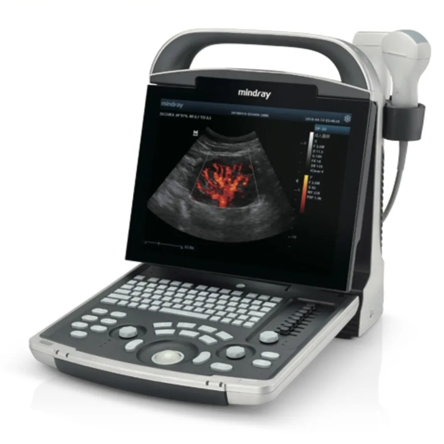 Original Veterinary Original DP30VET Digital Ultrasonic Diagnostic Imaging System Portable ultrasound machine ecografo mindray