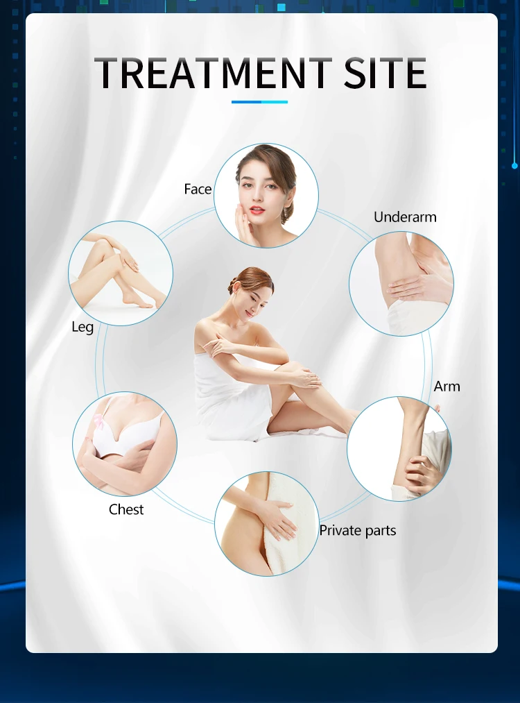 Hot Selling Customized Painless diode laser depilacion 808 nm hair laser depilator beauty 808 diode laser hair removal machine