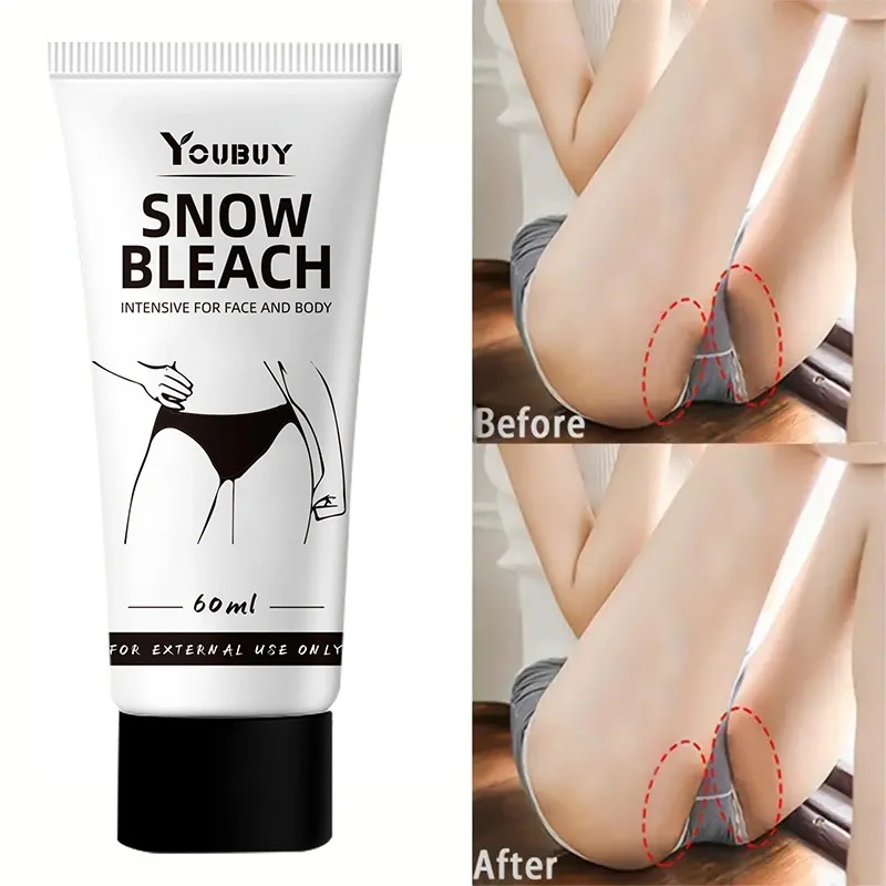Not Over Bleaching Inner Thigh Face Whitening Cream Skin Brightening And Lightening Dark Spot Corrector For Dark Area Armpit
