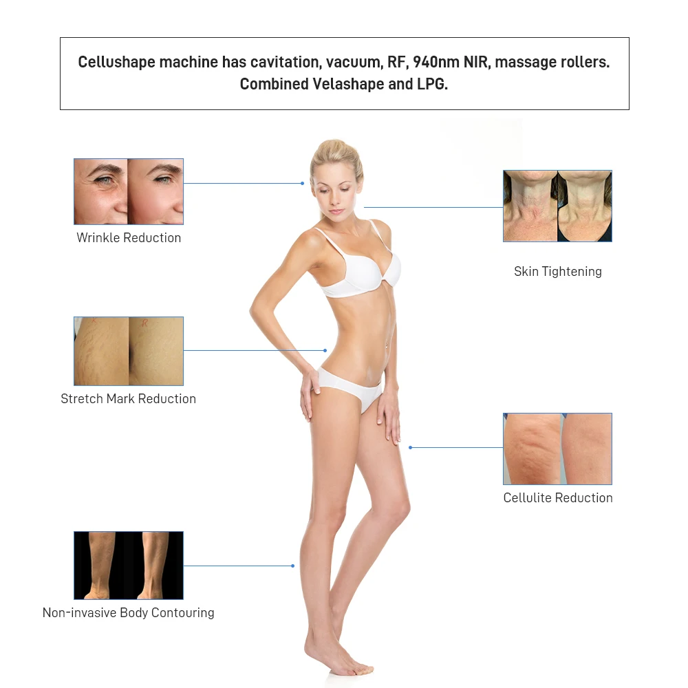 cavitation rf engraving lipase slimming machine