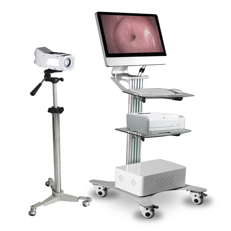 YSSW3304 Ysenemd HD Specialized Digital Optical colposcope workstation mobile colposcope 4k colposcope for gynecology trolley