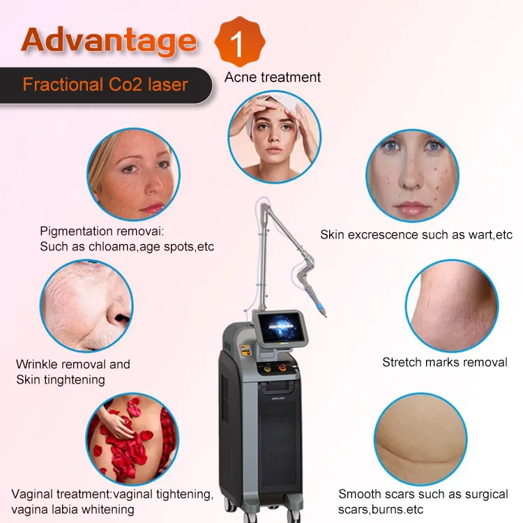 Medical Co2 Fractional Laser Skin Rejuvenation Acne Scar Removal Co2 Fractional laser Machine