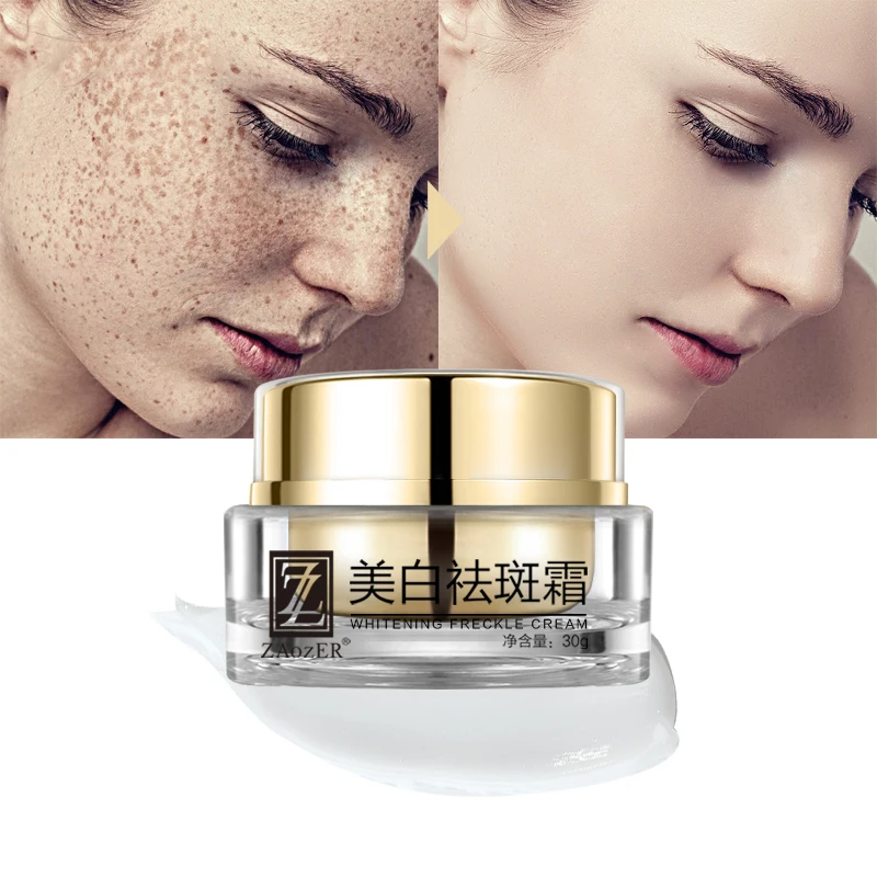 
 Best Korean Anti Freckles Beauty Skin Care Anti-Aging Face Cream Moisturizer Whitening Freckle Removing Cream  