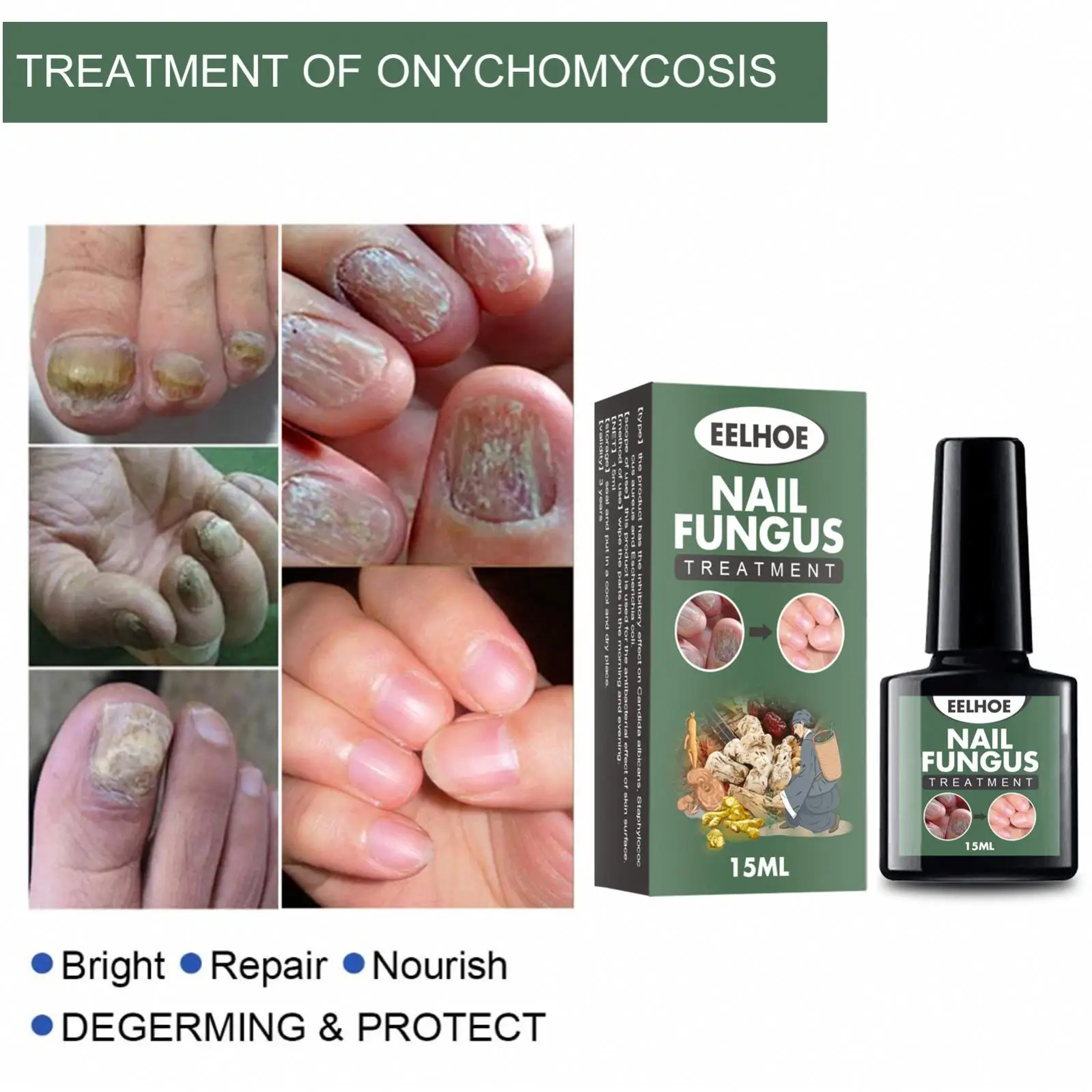 Costom Nail Repair Liquid Solution Fungal Nail Antifungal Anti Fungus Toe Nail Care Hand and Foot Onychomycosis Care