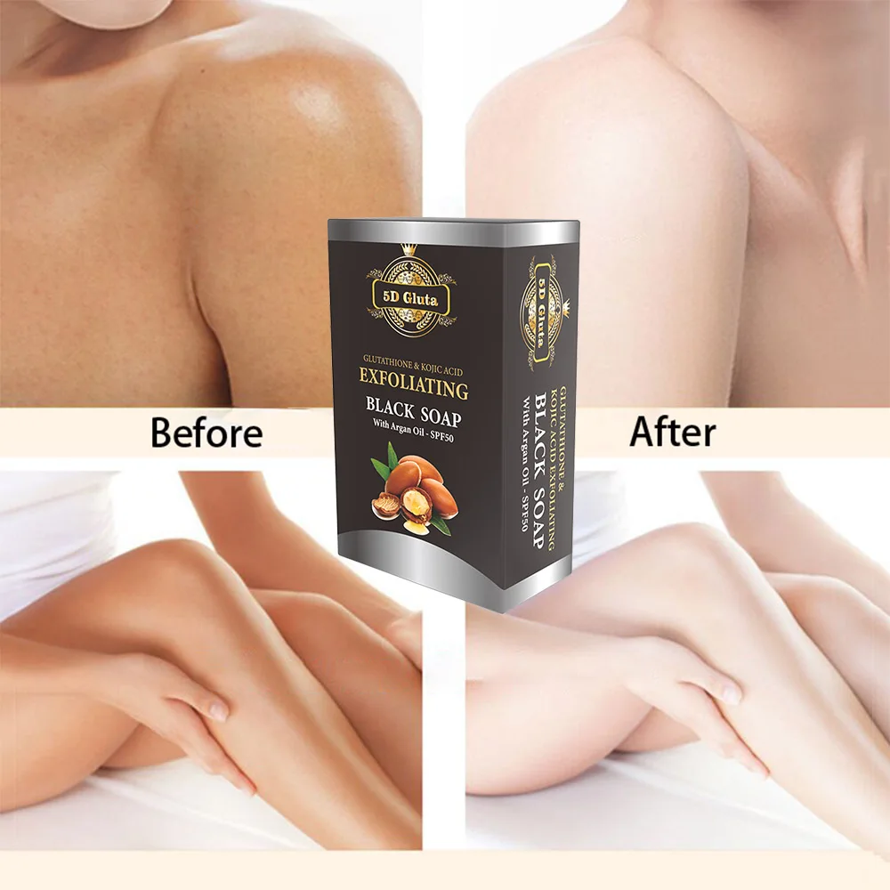  5D.Gluta. Отшелушивающее черное мыло с глютатионной койевой кислотой аргановое масло восстанавливает прыщи и кожу уменьшает акне мелкие