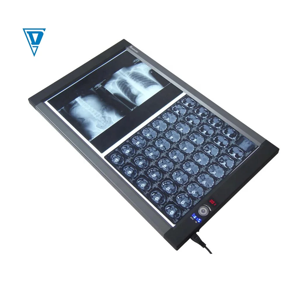 Medical LED X Ray Imaging Film Viewer view box dental x-ray film viewer