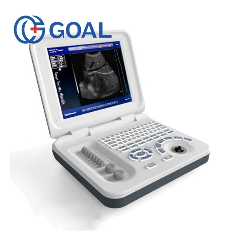 Новый продукт запуск в Китае беременность недели измерения полный цифровой 3d ультразвуковая машина цена