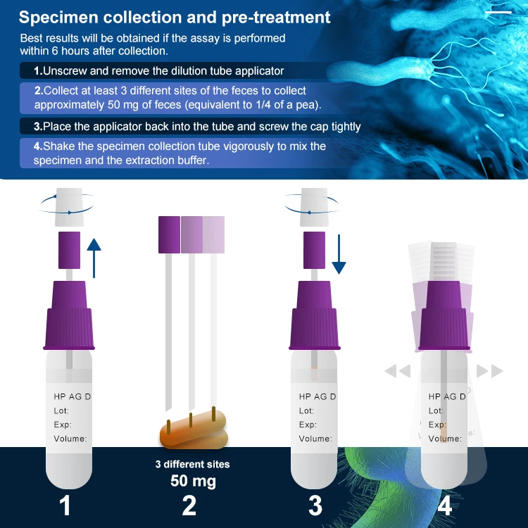 Infectious disease detection H. Pylori Infection HP Antigen Rapid Test
