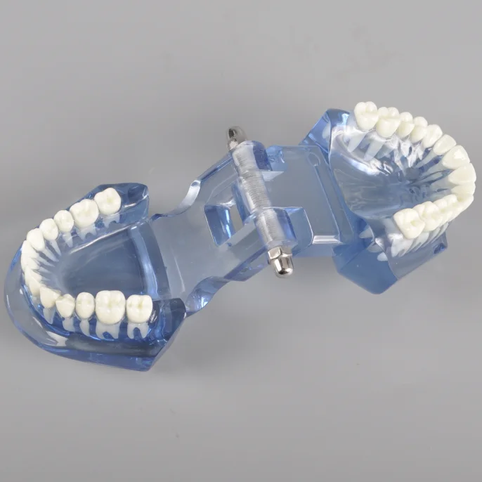 Новая модная Стоматологическая прозрачная модель, ортодонтика без кронштейнов
