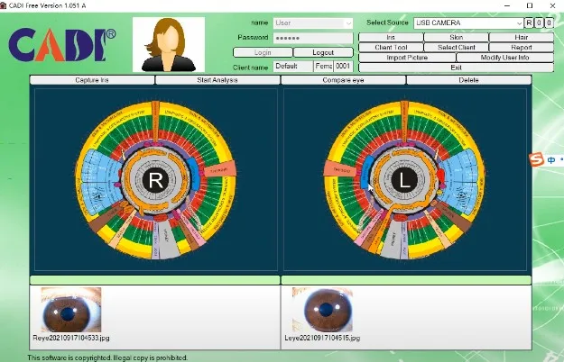 Skin iris analyzer digital iridology cameramachine iriscope scanner irisearch pro iriscope camera analysis meter for sale study