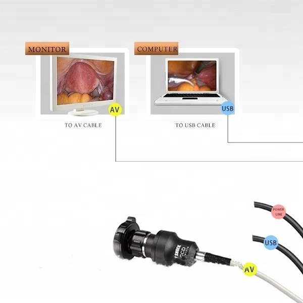 medical USB camera system for ENT endoscopy USB portable camera