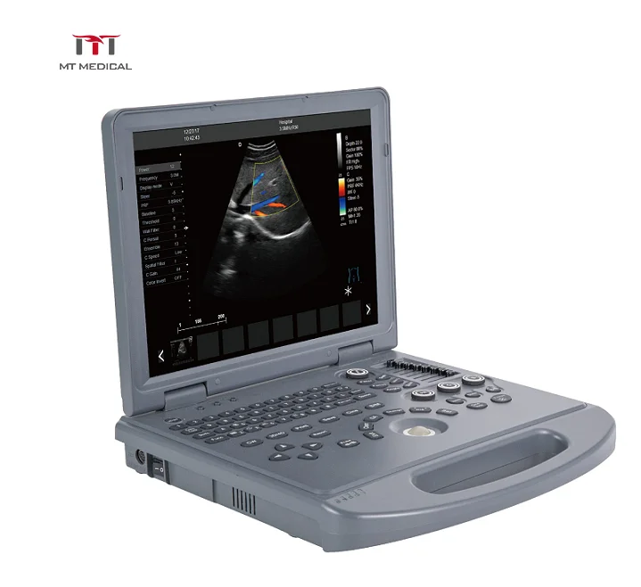 
Color Doppler 128 elements Laptop Ultrasound Machine 