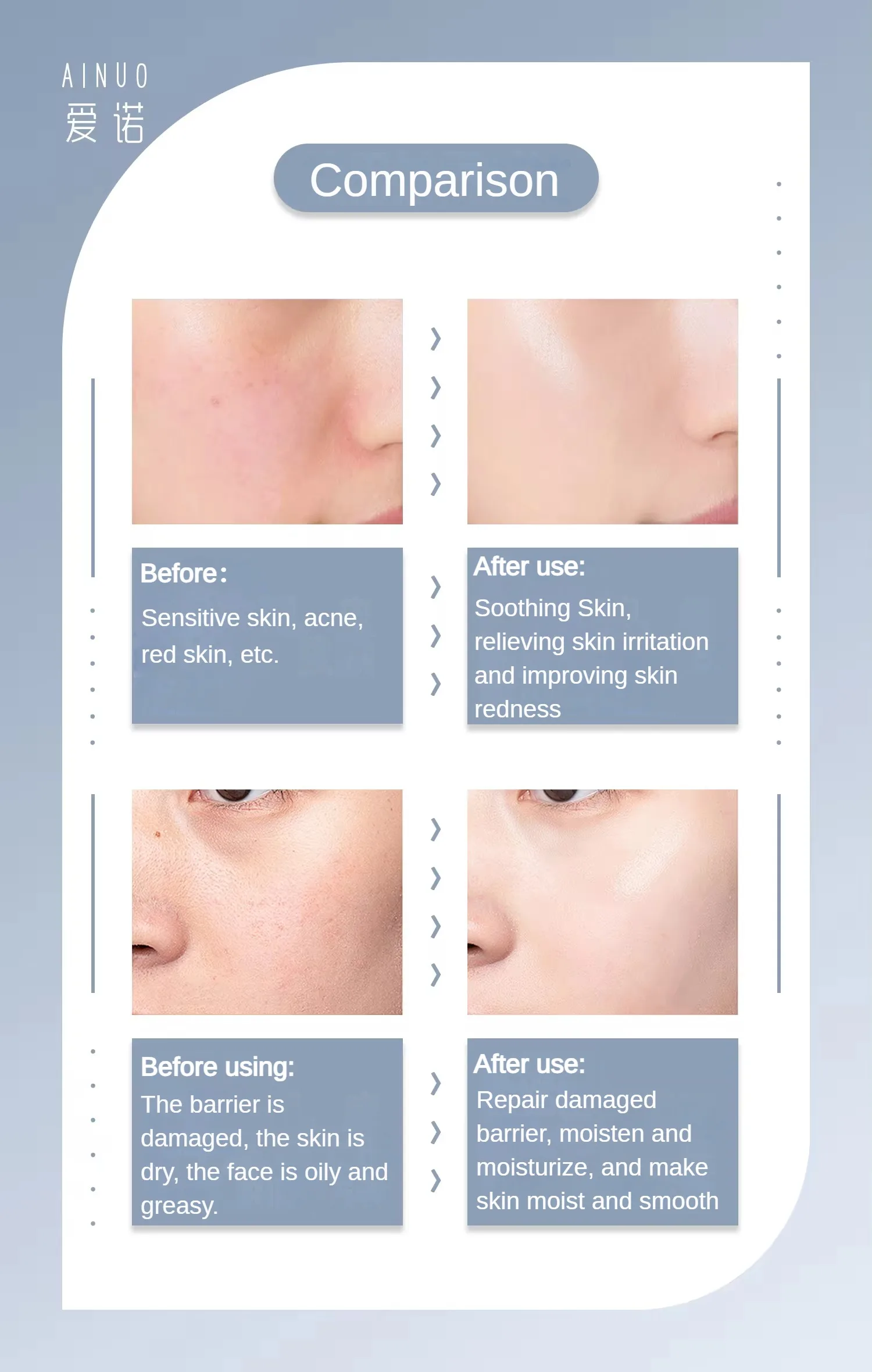 AINUO Enoch Repair Isolation Skin Retender Moisturizing Face Cream & Lotion Barrier Recovery