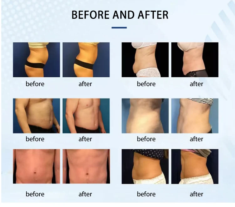 Physiotherapy Tens Device Muscle Stimulator Healthy Shaping Firming Enlargement High Energy for Pain Relief