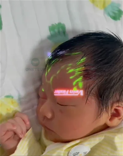 VF15 Powerful performance portable vein viewer for hands and feet and to detect face fillters