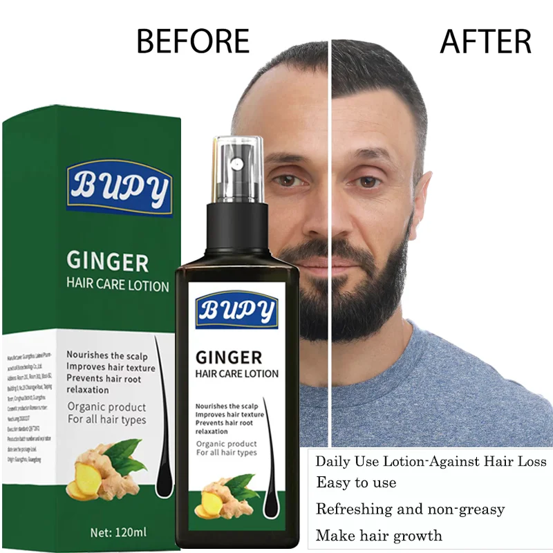 Good Product Ginger Hair Growth Liquid Spray Hair Regrowth Tonics Hair Loss Treatments Lotion Spray