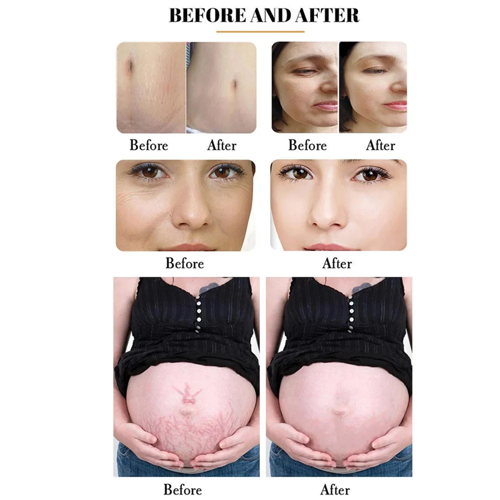 New Arrival Portable Skin Rejuvenation RF Fractional Co2 Laser Vaginal Tightening 360 Scar Removal Beauty Machine