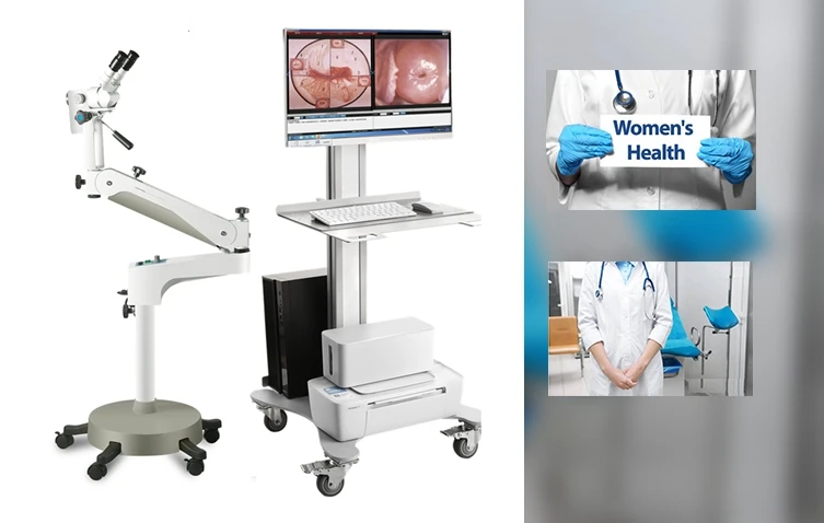 KN-2200I china colposcopy for gynecology to bay handy vaginal video colposcope portable gynecology colposcope supplier for sale