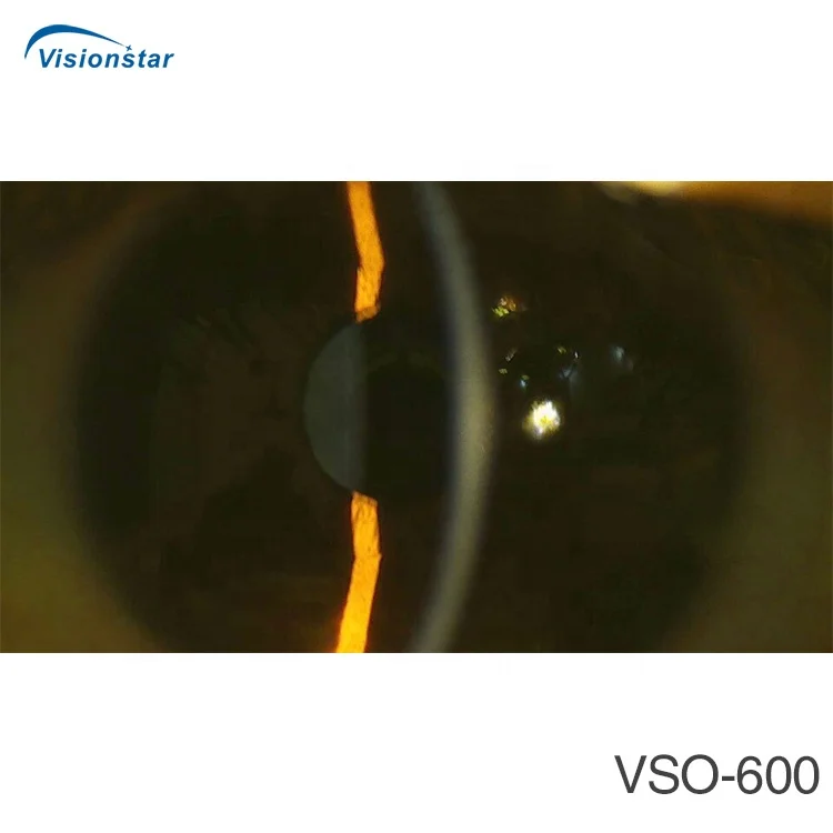 VSO-600 New Model Digital Portable Slit Lamp