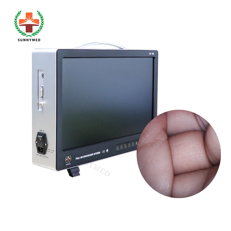 Эндоскоп HD laparascope эндоскоп для Hysteroscopy/артроскоп