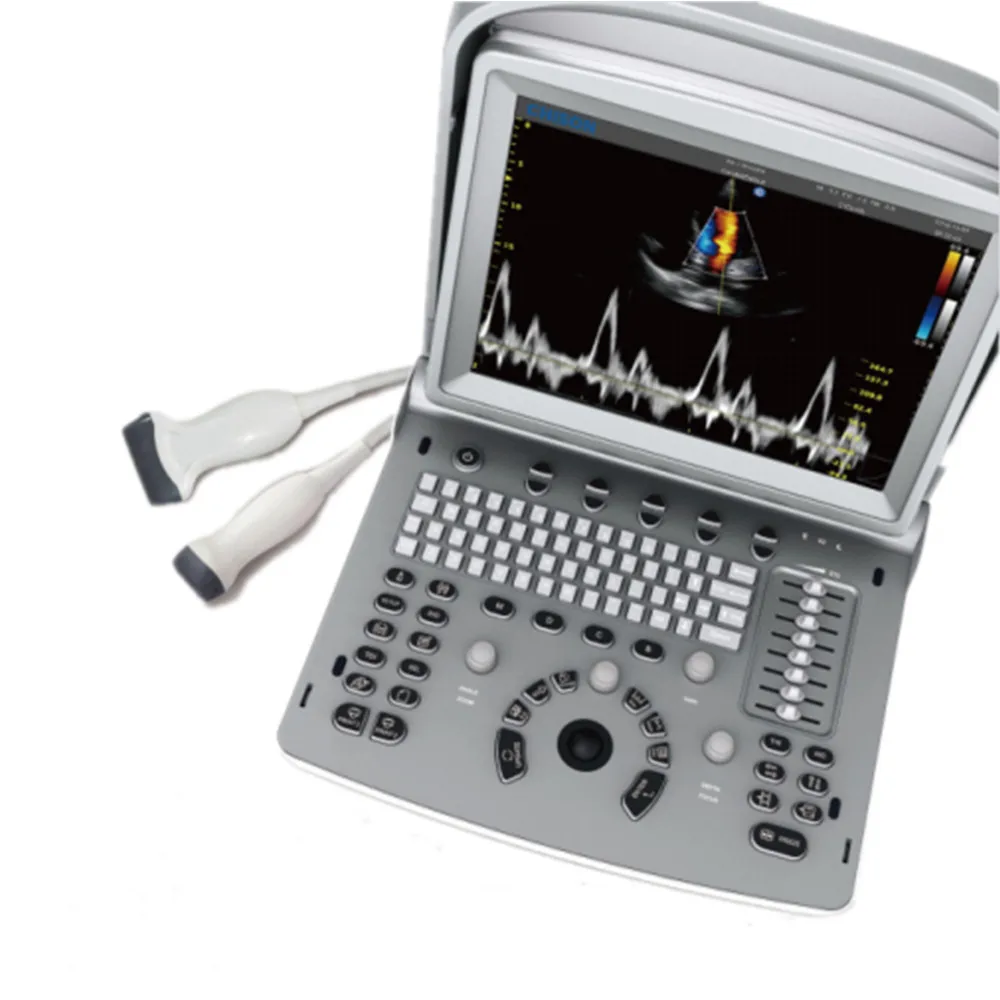 Chison ECO6 Promotion of the cheapest price Full digital ultrasound excellent 3D 4D color Doppler  ultrasound