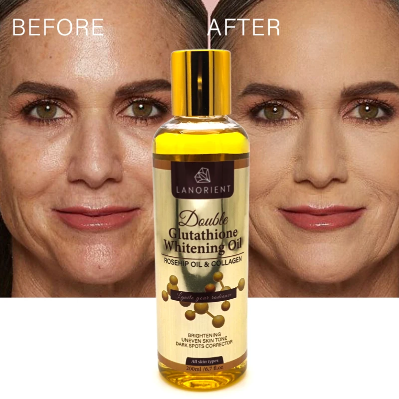 Private Label LANORIENT Skin Care Oil Organic Vitamin E Body Moisturizing Whitening Removing Dark Spots Rose Hip Essential Oil