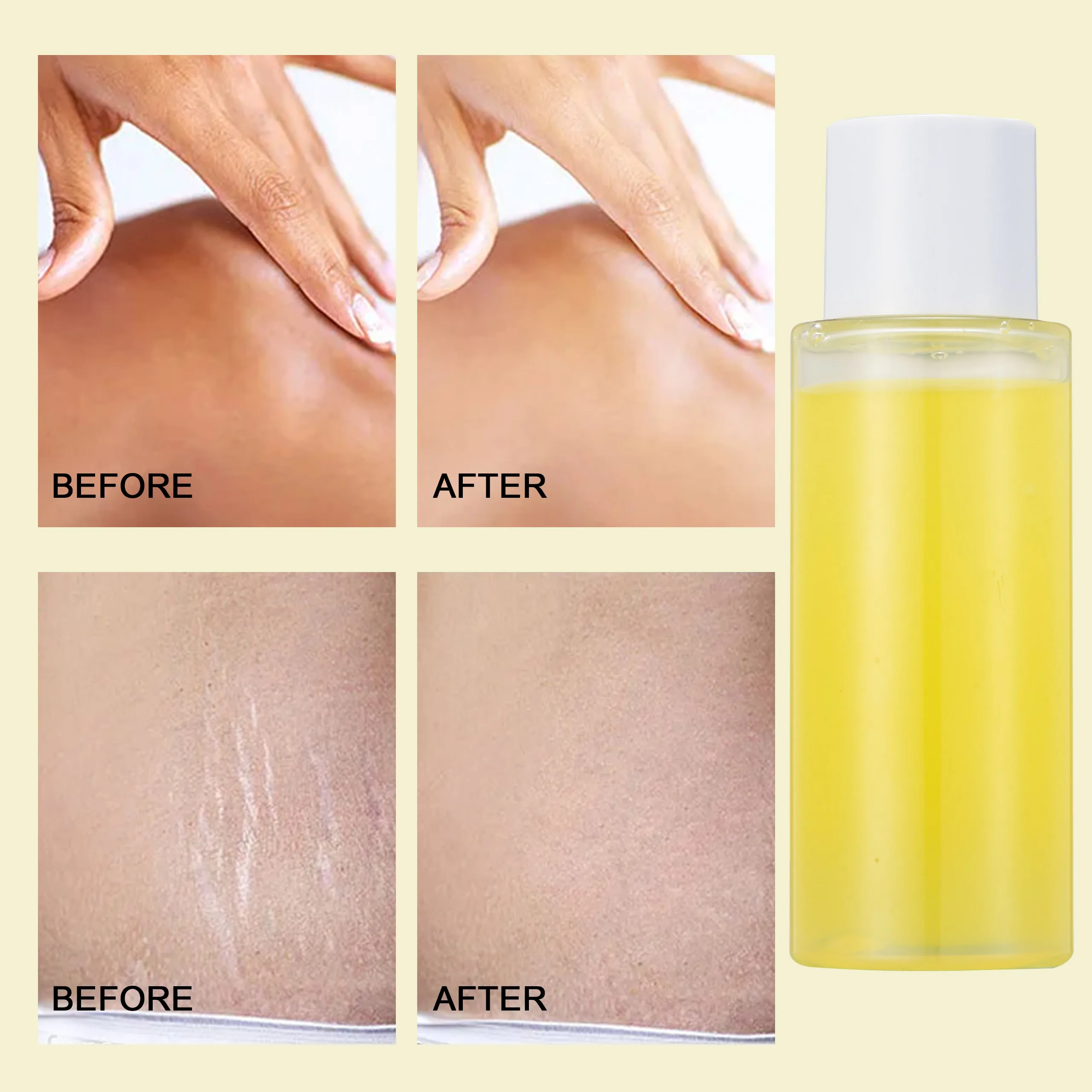 Private Label Blank Package Lower MOQ Extra Strong Bleaching Oil Dark Knees Knuckles Removal Skin Whitening Orange Yellow Peelin
