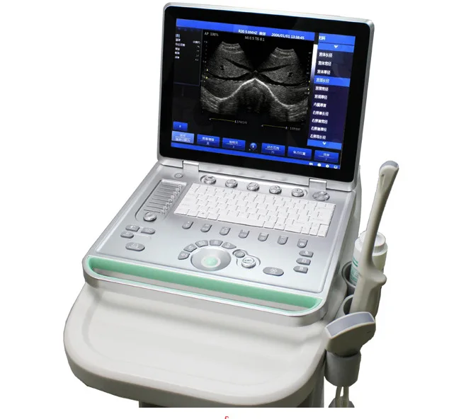 SS-8 полный цифровой портативный ультразвуковая машина для беременности медицинское ультразвуковое оборудование ультразвуковой класс II сковорода с переменным фокусным расстоянием