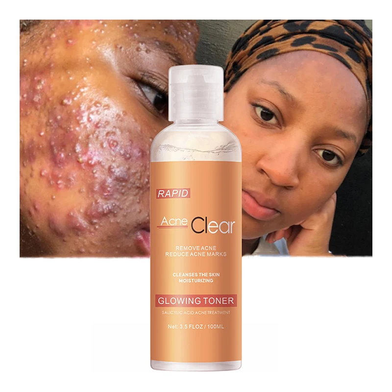 Оптовая продажа OEM ODM кислота салициловая кислота сыворотка частная этикетка для восстановления кожи лица Лечение Акне тонер