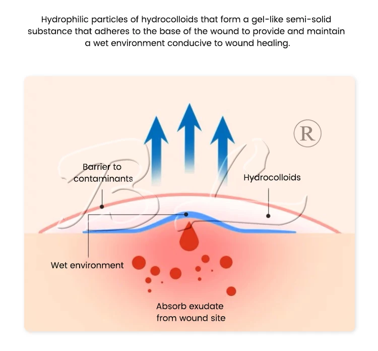 Invisible Waterproof Hydrocolloid Wound Dressing 10cm*10cm