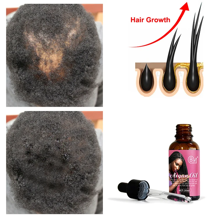 Best china hair growth oil custom logo pure  for men woman