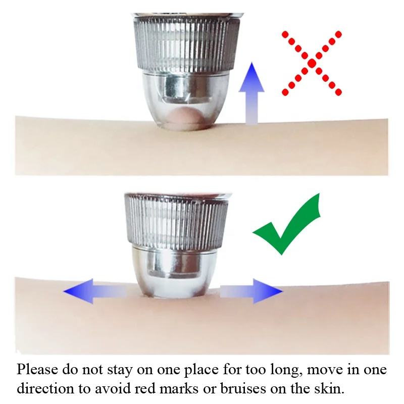 Electric Blackhead Acne Removal Vacuum Suction Blackhead Remover Vacuum Pore Cleaner