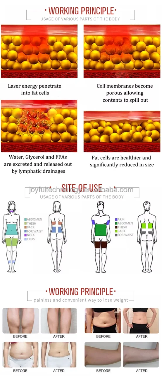 lipolaser aplication