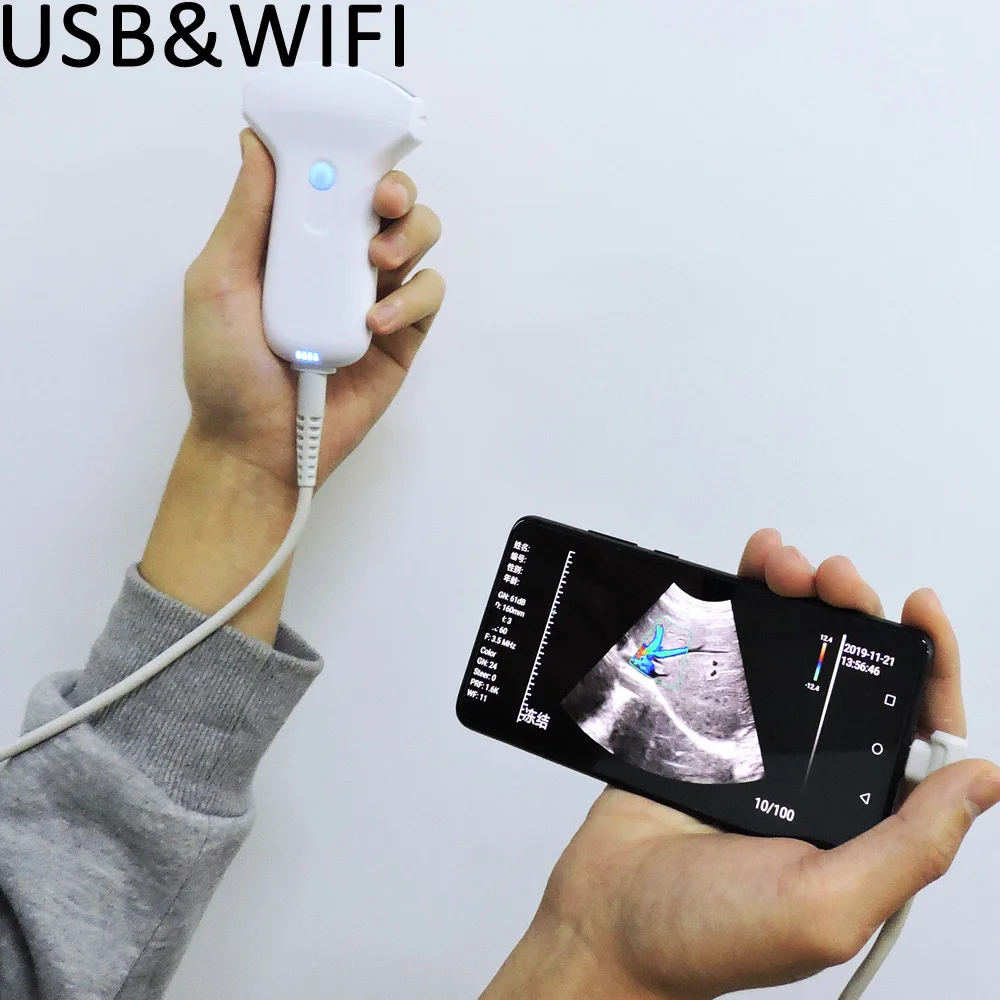Multifunction 7.5/10mhz Portable Small Ultrasound Usb/wireless Linear Probe Price