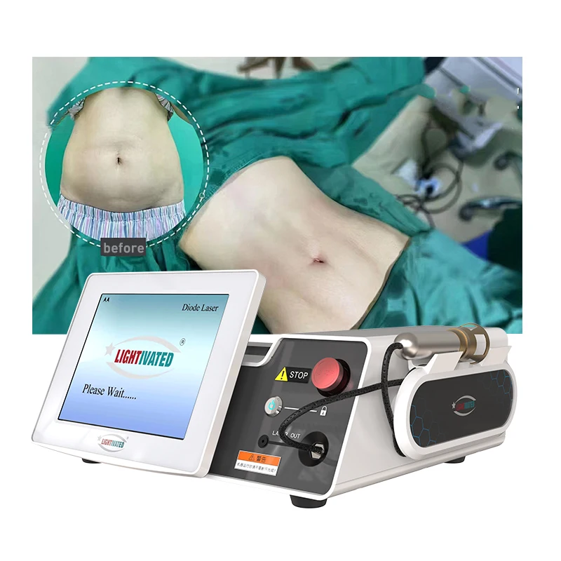 Fiber Endolaser Lipolysis Facial Body Lifting 980 1470nm Diode Laser Liposuction Canulas Fat Dissolving Medical Surgical Machine