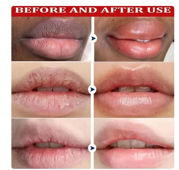 New Lip Balm Remove Dark Lighten Melanin Lip Mask Fade Lip Line Brighten Exfoliating Moisturize Dead Skin Repair