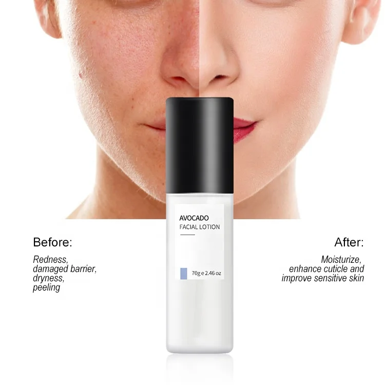 Custom Logo Korean Moisturizing Avocado Lotion Repair Face Lotion Korea Best Face Lotion for Oily Skin
