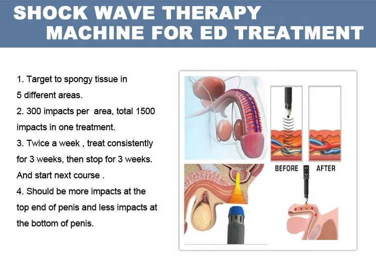 ultrasonic wave focus shockwave therapy machine manufacturer