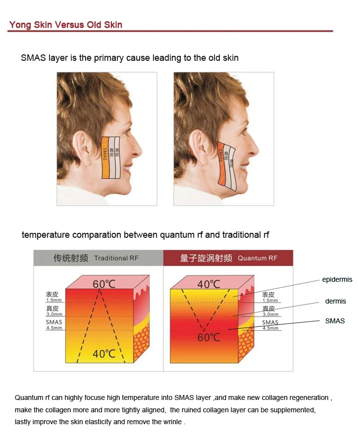 BECO new 2022 skin tightening RF EMS ice sculpture
