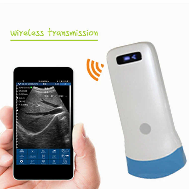 Factory price 128 elements ultrasound Scanning Probe Wireless Mini Ultrasounder linear convex ultrasound machine